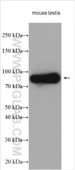 DDX4/VASA Antibody in Western Blot (WB)