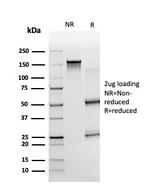 ZBTB7B Antibody in SDS-PAGE (SDS-PAGE)