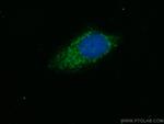 SIK1 Antibody in Immunocytochemistry (ICC/IF)