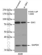 SIK1 Antibody in Western Blot (WB)