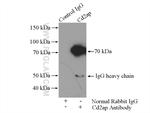 Cd2ap Antibody in Immunoprecipitation (IP)