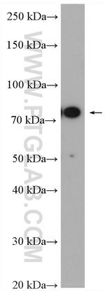 Cd2ap Antibody in Western Blot (WB)