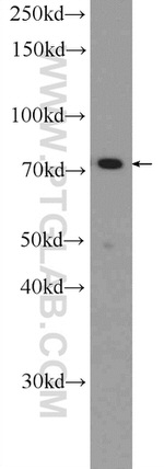 Cd2ap Antibody in Western Blot (WB)