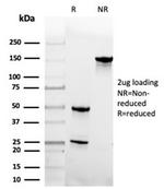 Geminin/DNA Replication Inhibitor Antibody in SDS-PAGE (SDS-PAGE)