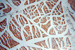 PLSCR3 Antibody in Immunohistochemistry (Paraffin) (IHC (P))