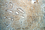 GSK3B Antibody in Immunohistochemistry (Paraffin) (IHC (P))