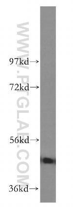 GSK3B Antibody in Western Blot (WB)