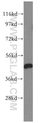 GSK3B Antibody in Western Blot (WB)