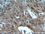 IkB alpha Antibody in Immunohistochemistry (Paraffin) (IHC (P))