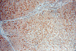 IkB alpha Antibody in Immunohistochemistry (Paraffin) (IHC (P))