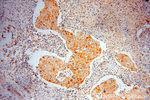 IkB alpha Antibody in Immunohistochemistry (Paraffin) (IHC (P))