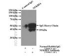 IkB alpha Antibody in Immunoprecipitation (IP)