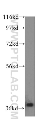 IkB alpha Antibody in Western Blot (WB)