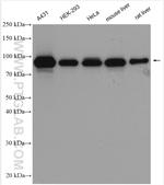 beta-Catenin Antibody in Western Blot (WB)