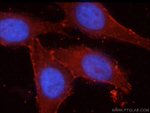 beta-Catenin Antibody in Immunocytochemistry (ICC/IF)