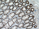 beta-Catenin Antibody in Immunohistochemistry (Paraffin) (IHC (P))