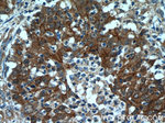 beta-Catenin Antibody in Immunohistochemistry (Paraffin) (IHC (P))