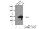 beta-Catenin Antibody in Immunoprecipitation (IP)
