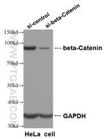 beta-Catenin Antibody in Western Blot (WB)