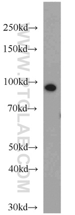 beta-Catenin Antibody in Western Blot (WB)