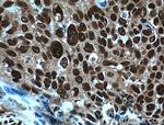 ERK1/2 Antibody in Immunohistochemistry (Paraffin) (IHC (P))