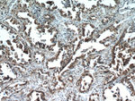 SMAD4 Antibody in Immunohistochemistry (Paraffin) (IHC (P))
