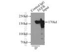 EGFR (C-terminal) Antibody in Immunoprecipitation (IP)