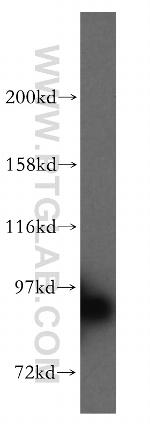 STAT5B Antibody in Western Blot (WB)