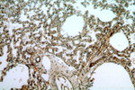 STAT6 Antibody in Immunohistochemistry (Paraffin) (IHC (P))