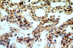 STAT6 Antibody in Immunohistochemistry (Paraffin) (IHC (P))