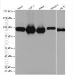 STAT6 Antibody in Western Blot (WB)