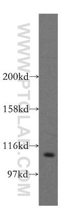 STAT6 Antibody in Western Blot (WB)