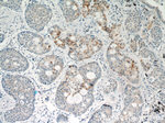 STAT5A Antibody in Immunohistochemistry (Paraffin) (IHC (P))