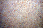 STAT2 Antibody in Immunohistochemistry (Paraffin) (IHC (P))