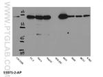 STAT2 Antibody in Western Blot (WB)