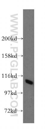 STAT2 Antibody in Western Blot (WB)