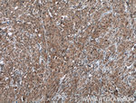 STAT3 Antibody in Immunohistochemistry (Paraffin) (IHC (P))