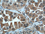 STAT3 Antibody in Immunohistochemistry (Paraffin) (IHC (P))