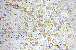 STAT3 Antibody in Immunohistochemistry (Paraffin) (IHC (P))