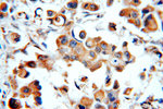 STAT3 Antibody in Immunohistochemistry (Paraffin) (IHC (P))