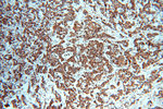 STAT3 Antibody in Immunohistochemistry (Paraffin) (IHC (P))