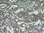 STAT3 Antibody in Immunohistochemistry (Paraffin) (IHC (P))