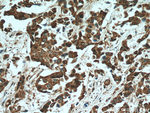 STAT3 Antibody in Immunohistochemistry (Paraffin) (IHC (P))