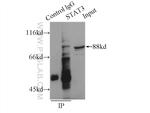 STAT3 Antibody in Immunoprecipitation (IP)