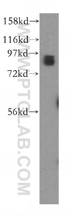 STAT3 Antibody in Western Blot (WB)