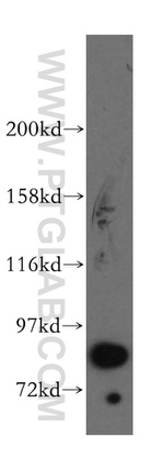 STAT3 Antibody in Western Blot (WB)