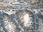 MEK1 Antibody in Immunohistochemistry (Paraffin) (IHC (P))