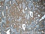 MEK1 Antibody in Immunohistochemistry (Paraffin) (IHC (P))