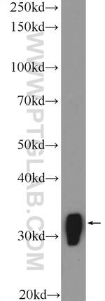 MARCKS Antibody in Western Blot (WB)