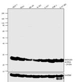 RhoGDI Antibody in Western Blot (WB)